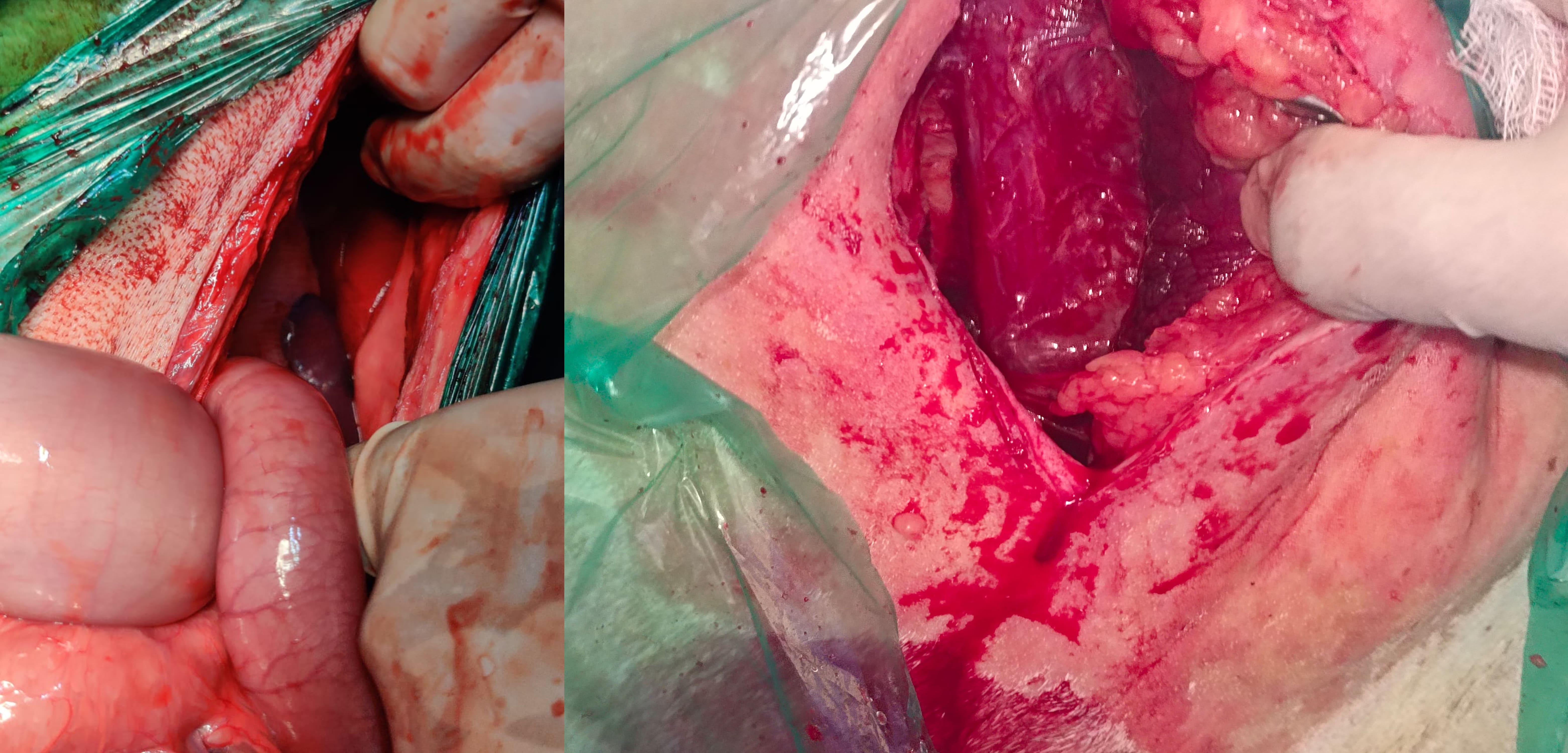 Caecal Dilatation Ruminant Surgery